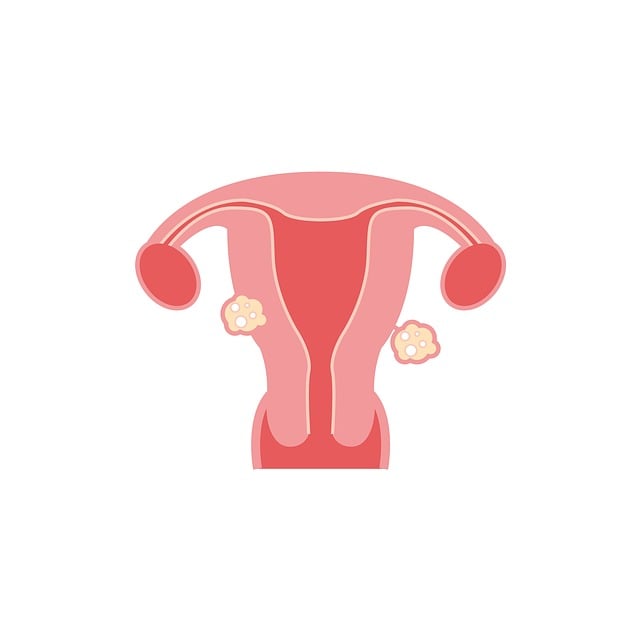 Fibroids Awareness Month 2025: Understanding, Empowering, and Supporting Women’s Health
